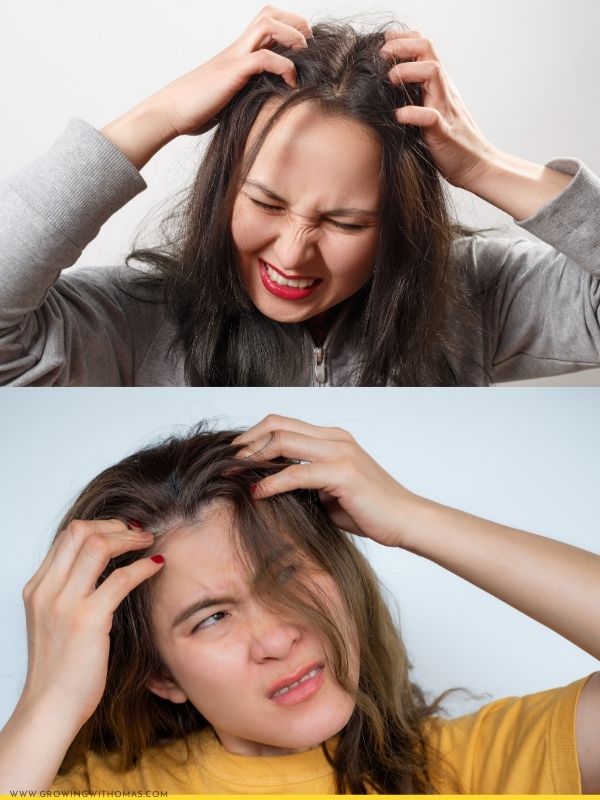 Someone-gently-touching-an-itchy-scalp.-featured-image-in-how-to-stop-an-itchy-scalp