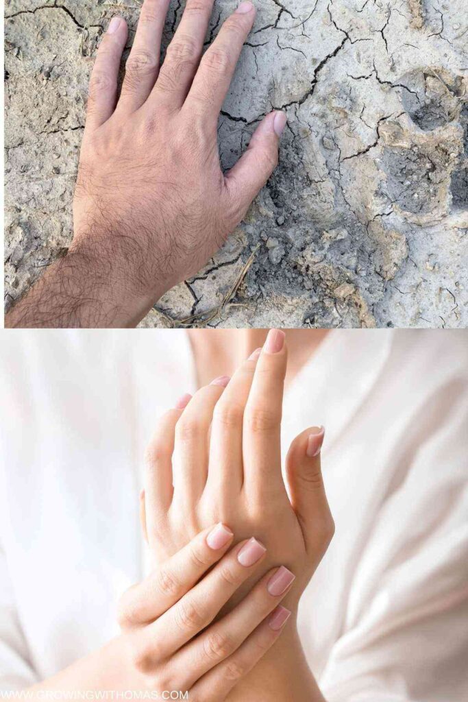 a-dry-and-healthy-hands-image
