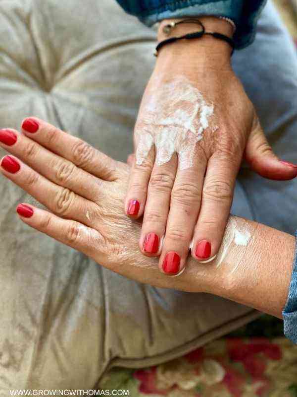 someone-applying-hand-cream-why-your-hands-stay-dry-even-after-using-hand-cream-featured-image